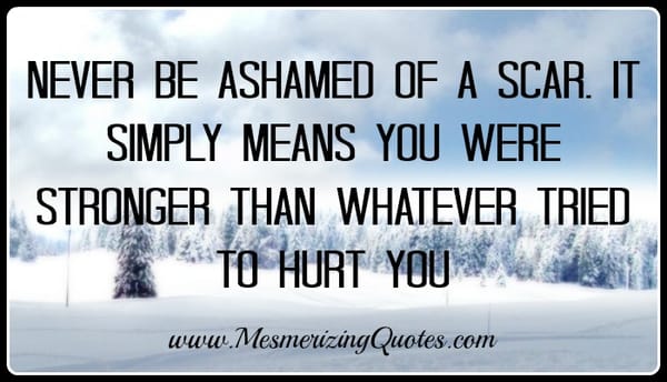 Never be ashamed of a scar