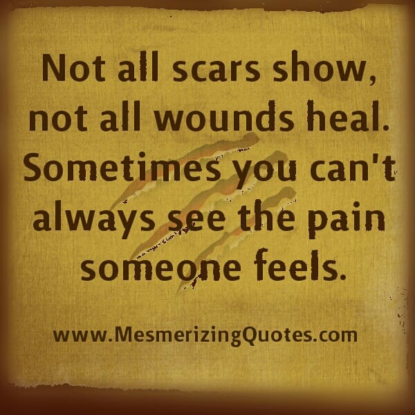You can't always see the pain someone feels